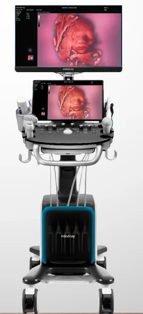 SISTEMA DE ULTRASONIDO NUEWA N9